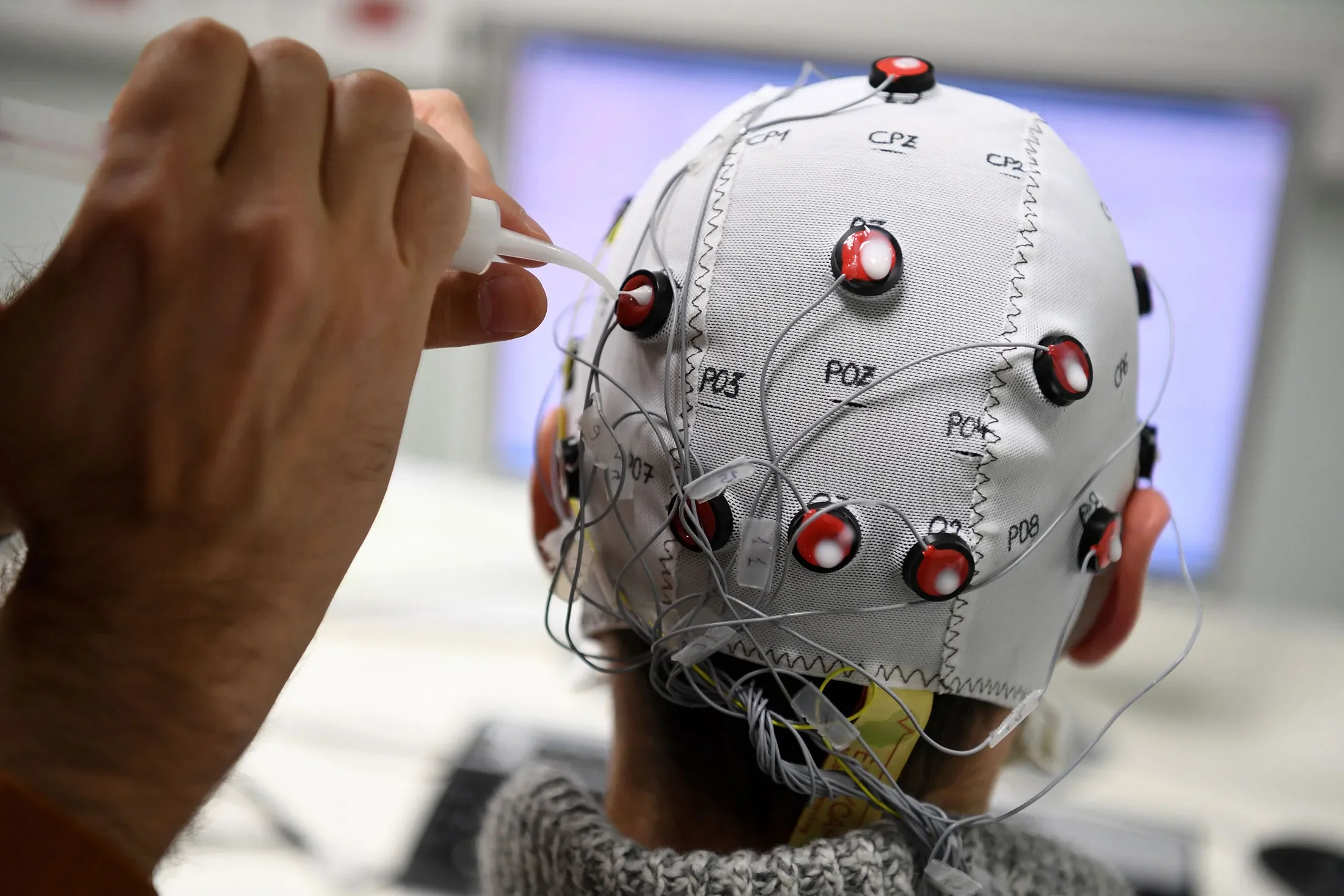 China Approves First Brain Implant for Commercial Use - Bloomberg